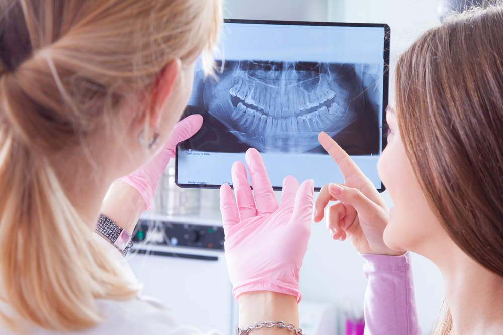cheching image of teeth