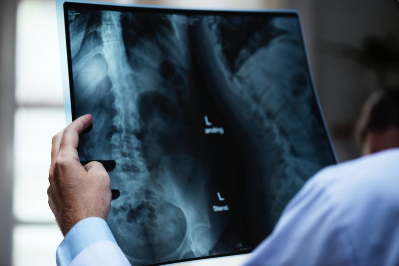 doctor holding x-ray test